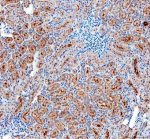 uPAR Antibody Rat Kidney IHC. Immunohistochemical staining of FFPE rat kidney tissue using uPAR Antibody at 2 ug/ml. HIER was performed in pH 8.0 EDTA buffer. An HRP-conjugated goat anti-rabbit IgG secondary antibody with DAB substrate was used for detection. uPAR Antibody, a Cell Invasion Receptor Antibody, demonstrates strong membranous and cytoplasmic staining in renal tubular epithelial cells, consistent with the role of PLAUR/uPA receptor in extracellular matrix remodeling, cell migration, and tissue remodeling processes.