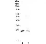 StAR Antibody for WB. Western blot analysis of Steroidogenic Acute Regulatory Protein (StAR / STARD1) using a rabbit polyclonal antibody in 1) rat testis lysate and 2) mouse testis lysate. A band is detected at approximately 30 kDa, consistent with the mature mitochondrial form of StAR following cleavage of the N-terminal targeting sequence. The predicted molecular weight of the StAR preprotein is approximately 37 kDa, while mitochondrial processing produces a mature form of about 30 kDa commonly observed in western blot analysis of steroidogenic tissues.