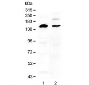 NEDD4 Antibody for WB Human Cell Lysate Western Blot. Western blot analysis of Neural precursor cell expressed developmentally down-regulated protein 4 / NEDD4 in human cell lysates using NEDD4 Antibody for WB. Lane 1: U-87 MG cell lysate, Lane 2: MDA-MB-453 cell lysate. A band is detected at approximately 140-150 kDa, consistent with the predicted molecular weight of NEDD4, with a possible lower band near ~95 kDa that may represent a cleavage product or processed isoform. The banding pattern is consistent with reported NEDD4 expression and proteolytic processing behavior observed in human cells.