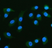 FABP5 Antibody A549 Cell IF. Immunofluorescent staining of FFPE human A549 cells with FABP5 antibody (green) and DAPI nuclear stain (blue). HIER: steam section in pH6 citrate buffer for 20 min.