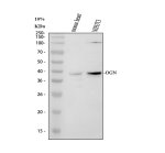 OIF Antibody by WB in Mouse Heart and NIH3T3 Cells. Western blot testing of mouse heart tissue lysate (lane 1) and mouse NIH3T3 whole cell lysate (lane 2) with OIF Antibody. A prominent band is detected at approximately 40 kDa in both samples, slightly above the predicted 34 kDa molecular weight of OGN. The Osteoinductive Factor Polyclonal Antibody produces particularly strong target-region reactivity in NIH3T3 cells, while mouse heart shows a weaker but distinct band at a similar position. Migration above the calculated protein mass is compatible with post-translational modification of osteoglycin.