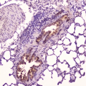Leptin Antibody Rat Kidney IHC. Immunohistochemistry analysis of FFPE rat kidney tissue using Leptin Antibody / Metabolic Signaling Hormone Antibody at 2 ug/ml. Renal tubular epithelial cells demonstrate diffuse HRP-DAB brown cytoplasmic staining consistent with leptin / LEP-associated metabolic signaling expression in kidney tissue, while nuclei are counterstained blue. HIER was performed by boiling tissue sections in pH6 10 mM citrate buffer for 10-20 minutes followed by cooling at room temperature for 20 minutes.