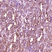Leptin Antibody Rat Kidney IHC. Immunohistochemistry analysis of FFPE rat kidney tissue using Leptin Antibody / Metabolic Signaling Hormone Antibody at 2 ug/ml. Renal tubular epithelial cells demonstrate HRP-DAB brown cytoplasmic staining consistent with leptin / LEP expression in kidney tissue, while glomerular regions display comparatively lower signal intensity. Nuclei are counterstained blue. HIER was performed by boiling tissue sections in pH6 10 mM citrate buffer for 10-20 minutes followed by cooling at room temperature for 20 minutes.