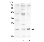 Leptin Antibody Mouse Tissue WB. Western blot analysis of mouse small intestine, mouse kidney, and mouse Neuro-2a cell lysates using Leptin Antibody / Metabolic Signaling Hormone Antibody at 0.5 ug/ml. Lane 1: mouse small intestine lysate, Lane 2: mouse kidney lysate, Lane 3: mouse Neuro-2a lysate. A distinct band is detected near 16-17 kDa, consistent with the predicted molecular weight of leptin / LEP. The observed signal pattern supports detection of this adipocyte-derived metabolic signaling hormone across mouse tissue and neuronal-derived cell lysate samples.