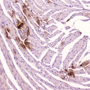 ANP Antibody Mouse Heart IHC. Immunohistochemistry staining of FFPE mouse heart tissue using ANP antibody demonstrates localized cytoplasmic staining within cardiac-associated cell populations, consistent with expression of Atrial Natriuretic Peptide (ANP/ANF). ANP is a peptide hormone encoded by the NPPA gene and functions as a key regulator of cardiovascular homeostasis, fluid balance, and natriuretic peptide signaling. The observed staining pattern is consistent with the established role of cardiac tissue as a primary site of ANP production and endocrine activity. These findings support the utility of ANP antibody for studies of cardiac hormone biology, cardiovascular signaling pathways, and endocrine regulation. HIER: boil tissue sections in pH6 10mM citrate buffer for 10-20 min followed by cooling at room temperature for 20 min.