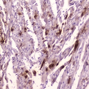 ANP Antibody Rat Heart IHC. Immunohistochemistry staining of FFPE rat heart tissue using ANP antibody demonstrates localized cytoplasmic staining within cardiac muscle-associated cell populations, consistent with expression of Atrial Natriuretic Peptide (ANP/ANF). ANP is a cardiac-derived peptide hormone encoded by the NPPA gene that participates in natriuretic peptide signaling pathways regulating cardiovascular homeostasis, circulatory balance, and endocrine communication. The observed staining pattern is consistent with the established role of cardiac tissue as a major source of ANP production and secretion. These findings support the utility of ANP antibody for studies of cardiac endocrine function, cardiovascular signaling, and peptide hormone biology. HIER: boil tissue sections in pH6 10mM citrate buffer for 10-20 min followed by cooling at room temperature for 20 min.