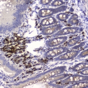 HE4 Antibody Rat Small Intestine IHC. Immunohistochemistry was performed on FFPE rat small intestine tissue using HE4 Antibody at 0.5 ug/mL. Heat-induced epitope retrieval was carried out in pH 6 citrate buffer for 10-20 minutes, followed by cooling to room temperature before incubation with the primary antibody. Bound antibody was visualized using an HRP-conjugated secondary antibody and DAB chromogen. Distinct cytoplasmic staining is observed in cells within the intestinal tissue, consistent with HE4 expression, while surrounding tissue shows minimal background staining. These results demonstrate that this Human Epididymis Protein 4 Antibody is suitable for detecting HE4 in formalin-fixed, paraffin-embedded rat tissue by immunohistochemistry.