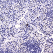 HE4 Antibody Rat Spleen IHC. Immunohistochemistry was performed on FFPE rat spleen tissue using HE4 Antibody at 0.5 ug/mL. Heat-induced epitope retrieval was carried out in pH 6 citrate buffer for 10-20 minutes, followed by cooling to room temperature before incubation with the primary antibody. Bound antibody was visualized using an HRP-conjugated secondary antibody and DAB chromogen. Distinct staining is observed in a limited population of splenic cells, while the majority of surrounding tissue remains negative, demonstrating selective HE4 expression with low background. These results support the use of this Human Epididymis Protein 4 Antibody for immunohistochemical detection of HE4 in formalin-fixed, paraffin-embedded rat tissues.