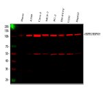 HSP105 Antibody Human Cancer and Stress-Responsive Cell Fluorescent WB. Western blot analysis was performed with HSP105 Antibody, also called Heat Shock Protein 105 Antibody, using human 1) HaCaT, 2) A549, 3) Caco-2, 4) MCF-7, 5) PC-3, 6) SH-SY5Y, 7) U251 and 8) HepG2 whole cell lysates. Samples were loaded at 30 ug per lane, and the antibody was used at 0.5 ug/ml overnight at 4oC followed by a Fluoro647-conjugated secondary antibody. A prominent HSP105/HSPH1 band is detected at approximately 105 kDa, near the expected molecular weight of approximately 97 kDa. This HSP105 Antibody demonstrates fluorescent western blot detection of Heat Shock Protein 105 across diverse human cell lines.