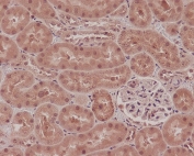 NOX4 Antibody Rat Kidney IHC. Immunohistochemistry was performed on FFPE rat kidney tissue using NOX4 Antibody at 2 ug/ml. Heat-induced epitope retrieval was carried out in pH 6 citrate buffer prior to antibody incubation. Bound antibody was visualized using an HRP-conjugated secondary antibody with DAB chromogen. Moderate to strong cytoplasmic staining is observed throughout the renal tubular epithelium, while glomeruli exhibit comparatively weaker immunoreactivity, consistent with the established renal expression pattern of NOX4. These results demonstrate that this Hydrogen Peroxide Producing Enzyme Antibody is suitable for immunohistochemical detection of NOX4 in formalin-fixed, paraffin-embedded rat kidney tissue.