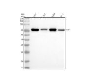CDT1 Antibody Human Cell Line WB. Western blot analysis of CDT1 using anti-CDT1 antibody demonstrates a distinct immunoreactive band at approximately 70 kDa in human 293T, K562, Jurkat, and PC-3 cell lysates, consistent with the expected molecular weight of Chromatin Licensing and DNA Replication Factor 1 (CDT1). CDT1 is a DNA replication licensing factor that regulates pre-replication complex assembly and ensures accurate genome duplication during cell cycle progression. The observed expression across multiple human cell lines supports the utility of this antibody for investigating DNA replication licensing, cellular proliferation, cell cycle control, and genome stability pathways. Western blot was performed using a 1:500 dilution of primary antibody. Predicted molecular weight: 60-65 kDa; commonly observed at approximately 60-70 kDa.