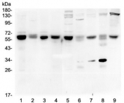 Western blot testing of 1) rat testis, 2) rat liver, 3) rat brain, 4) rat lung, 5) mouse testis, 6) mouse liver, 7) mouse brain, 8) mouse lung and 9) mouse HEPA1-6 lysate with ARSA antibody at 0.5ug/ml. Expected molecular weight: 53-63 kDa.
