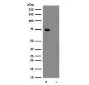 Phospho-NF-kB p65 Antibody Daudi WB. Western blot analysis of human Daudi cell lysates untreated (-) or treated (+) with Calyculin A and TNF-alpha using phospho-NF-kB p65 antibody detecting p65 phosphorylated at Ser529, clone AbN84. A band is observed at approximately 65-75 kDa, consistent with the predicted molecular weight of p65 and potential phosphorylation-associated mobility shifts. Signal intensity is increased in the treated sample, supporting its role as an activation marker in NF-kB-mediated inflammatory signaling.