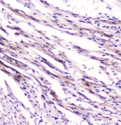 FABP3 Antibody Rat Cardiac Tissue Immunohistochemistry. IHC testing of FFPE rat heart tissue with FABP3 antibody at 1ug/ml. HIER: boil tissue sections in pH6, 10mM citrate buffer, for 10-20 min followed by cooling at RT for 20 min.