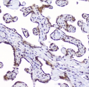 AHR Antibody Placental Villi IHC. Immunohistochemical staining of FFPE human placenta demonstrates AHR expression using an AHR antibody at 1 ug/ml. AHR, also known as Aryl Hydrocarbon Receptor and an Environmental Sensor Protein, is a ligand activated transcription factor that regulates xenobiotic metabolism, developmental signaling, and immune tolerance at the maternal fetal interface. Focal nuclear and cytoplasmic staining is observed in trophoblastic cells lining the chorionic villi, consistent with the role of AHR in placental homeostasis and responses to endogenous metabolites. Heat induced epitope retrieval was performed by boiling tissue sections in pH 6 10 mM citrate buffer for 10-20 minutes followed by cooling at room temperature for 20 minutes. These results support the utility of AHR Antibody for studies of reproductive biology, developmental signaling, and environmental response pathways.