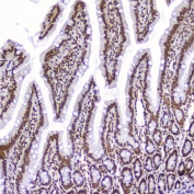 AHR Antibody Rat Small Intestine IHC. Immunohistochemical staining of FFPE rat small intestine demonstrates AHR expression using an AHR antibody at 1 ug/ml. AHR, also known as Aryl Hydrocarbon Receptor and an Environmental Sensor Protein, is a ligand activated transcription factor that integrates dietary, microbial, and xenobiotic signals to regulate intestinal homeostasis and mucosal immunity. Prominent nuclear staining is observed throughout the villous epithelium and crypt compartments, consistent with active AHR signaling in absorptive enterocytes and its established role in maintaining epithelial barrier integrity. Heat induced epitope retrieval was performed by boiling tissue sections in pH 6 10 mM citrate buffer for 10-20 minutes followed by cooling at room temperature for 20 minutes. These findings support the utility of AHR Antibody for studies of gastrointestinal physiology, host-microbiome interactions, and immune regulation.