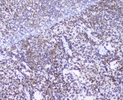 AHR Antibody Rat Spleen IHC. Immunohistochemical staining of FFPE rat spleen demonstrates AHR expression using an AHR antibody at 1 ug/ml. AHR, also known as Aryl Hydrocarbon Receptor and an Environmental Sensor Protein, is a ligand activated transcription factor that regulates immune cell differentiation and inflammatory responses through sensing of endogenous metabolites and environmental ligands. Widespread nuclear staining is observed throughout lymphoid regions, with prominent reactivity in splenic immune cell populations, consistent with the established role of AHR in maintaining immune homeostasis and modulating adaptive immunity. Heat induced epitope retrieval was performed by boiling tissue sections in pH 6 10 mM citrate buffer for 10-20 minutes followed by cooling at room temperature for 20 minutes. These results support the utility of AHR Antibody for studies of immunology, signal transduction, and environmental sensing mechanisms.