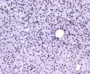 AHR Antibody Mouse Liver IHC. Immunohistochemical staining of FFPE mouse liver demonstrates AHR expression using an AHR antibody at 1 ug/ml. AHR, also known as Aryl Hydrocarbon Receptor and an Environmental Sensor Protein, is a ligand activated transcription factor that regulates xenobiotic metabolism and coordinates cellular responses to endogenous and environmental ligands. Predominantly nuclear staining is observed throughout hepatocytes, consistent with active transcriptional signaling and the well-established role of AHR in hepatic detoxification pathways. Heat induced epitope retrieval was performed by boiling tissue sections in pH 6 10 mM citrate buffer for 10-20 minutes followed by cooling at room temperature for 20 minutes. These results support the utility of AHR Antibody for studies of liver physiology, toxicology, and metabolic regulation.