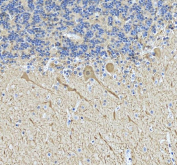 IHC staining of FFPE human cerebellum tissue with Calbindin antibody at 2ug/ml, HRP-secondary and DAB substrate. HIER: boil tissue sections in pH8 EDTA for 20 min and allow to cool before testing.