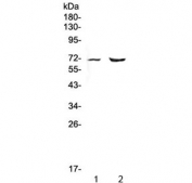 PMEL17 Antibody for Mouse and Rat. Western blot analysis of rodent tissue lysates using PMEL17 Antibody for Mouse and Rat. Lane 1: rat heart lysate. Lane 2: mouse heart lysate. A band is detected at approximately 70 kDa, consistent with the predicted molecular weight of Premelanosome protein PMEL (also known as gp100). PMEL is synthesized as a glycosylated precursor that can migrate at higher apparent molecular weights near approximately 100 kDa due to glycosylation. The detected band in rodent samples aligns with expected expression of PMEL-derived protein species recognized by the antibody.