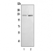 CDH3 Antibody Human Epithelial Cell WB. Western blot analysis of human A431 and HaCaT cell lysates using CDH3 Antibody / Cadherin 3 Antibody. Lane 1: human A431 cells; Lane 2: human HaCaT cells. Specific bands are detected between approximately 100â130 kDa, consistent with the expected migration range of glycosylated Cadherin 3. The unmodified CDH3 protein has a predicted molecular weight of approximately 91 kDa. These results support the use of CDH3 Antibody / Cadherin 3 Antibody for studying Cadherin 3 expression, epithelial cell adhesion and cell junction regulation.