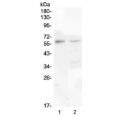 Western blot analysis of CSF1 antibody in human tissues. Human placenta (lane 1) and human 293T whole cell lysate (lane 2) were resolved by SDS-PAGE under reducing conditions and probed with CSF1 antibody at 0.5 ug/ml. The antibody used is a Rabbit Polyclonal reagent. A prominent immunoreactive band is detected at approximately 60 kDa in both samples, consistent with the predicted molecular weight of Colony stimulating factor 1. The observed banding pattern supports detection of endogenous CSF1 protein in human lysates.