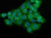NSE Antibody for IF human A431 cell immunofluorescence staining. Immunofluorescence analysis of ENO2 expression in FFPE human A431 cells using NSE Antibody for IF demonstrates cytoplasmic green fluorescence consistent with Neuron Specific Enolase localization, while nuclei are counterstained with DAPI (blue). The staining pattern highlights ENO2-positive cells with clear cytoplasmic distribution and minimal background. Heat-induced epitope retrieval was performed using pH 6 citrate buffer with steam treatment for 20 min prior to staining.