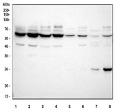 Western blot analysis using TIM1 antibody. Lane 1: human 293T whole cell lysate; Lane 2: human HepG2 whole cell lysate; Lane 3: human A549 whole cell lysate; Lane 4: human Caco-2 whole cell lysate; Lane 5: rat kidney tissue lysate; Lane 6: rat testis tissue lysate; Lane 7: mouse kidney tissue lysate; Lane 8: mouse testis tissue lysate. The predicted molecular weight of TIM-1 is ~39 kDa, while TIM1 antibody detects a dominant band at ~60 kDa on SDS-PAGE, consistent with the mature glycosylated form of this type I transmembrane protein. Additional bands likely reflect alternative glycosylation or processing states.
