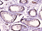 RAD51 Antibody Human Testis IHC. Immunohistochemical staining of FFPE human testis demonstrates RAD51 expression using a RAD51 antibody at 1 ug/ml. RAD51, also known as RAD51 Recombinase, is a key DNA repair protein that mediates homologous recombination and maintains genomic stability during meiosis and spermatogenesis. Predominantly nuclear staining is observed within seminiferous tubules, consistent with the high levels of DNA repair activity required for germ cell development. Heat induced epitope retrieval was performed by boiling tissue sections in pH6 10 mM citrate buffer for 10 to 20 minutes followed by cooling at room temperature for 20 minutes prior to staining. These results support the utility of RAD51 Antibody for investigating DNA damage responses, meiotic recombination, and reproductive biology.