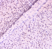 RAD51 Antibody Mouse Brain IHC. Immunohistochemical staining of FFPE mouse brain demonstrates RAD51 expression using a RAD51 antibody at 1 ug/ml. RAD51, also known as RAD51 Recombinase, is a central DNA repair protein that mediates homologous recombination and maintains genomic stability. Predominantly nuclear staining is observed in cells of the cerebellar granular layer, consistent with the requirement for efficient DNA damage responses in neural tissues. Heat induced epitope retrieval was performed by boiling tissue sections in pH6 10 mM citrate buffer for 10 to 20 minutes followed by cooling at room temperature for 20 minutes prior to staining. These results support the utility of RAD51 Antibody for investigating DNA repair pathways, genome maintenance, and nervous system development.
