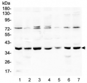 RAD51 Antibody Human Cell Lines WB. Western blot analysis of RAD51 expression using a RAD51 antibody at 0.5 ug/ml. Lane 1: human HeLa cell lysate. Lane 2: human A431 cell lysate. Lane 3: human 293T cell lysate. Lane 4: human K562 cell lysate. Lane 5: human Jurkat cell lysate. Lane 6: human A549 cell lysate. Lane 7: human Caco-2 cell lysate. RAD51, also known as RAD51 Recombinase, is a key DNA repair protein that mediates homologous recombination and preserves genomic stability. A prominent band is detected at approximately 37 kDa in all cell lines, consistent with the predicted molecular weight of RAD51. Faint higher molecular weight bands are also observed in some lysates and may represent post translationally modified or multimeric forms of RAD51. These results demonstrate endogenous expression of this DNA repair protein across multiple human cell types and support the utility of RAD51 Antibody for studies of DNA damage responses, genome maintenance, and cancer biology.