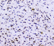 RAD51 Antibody Rat Brain IHC. Immunohistochemical staining of FFPE rat brain demonstrates RAD51 expression using a RAD51 antibody at 1 ug/ml. RAD51, also known as RAD51 Recombinase, is a central DNA repair protein that mediates homologous recombination and preserves genomic stability in proliferating and differentiated cells. Predominantly nuclear staining is observed in scattered neural cells, consistent with the requirement for efficient DNA damage responses and chromosome maintenance in the nervous system. Heat induced epitope retrieval was performed by boiling tissue sections in pH6 10 mM citrate buffer for 10 to 20 minutes followed by cooling at room temperature for 20 minutes prior to staining. These results support the utility of RAD51 Antibody for investigating DNA repair pathways, genome maintenance, and neural development.