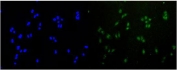 RAD51 Antibody U-2 OS Cells IF. Immunofluorescent staining of FFPE human U-2 OS cells demonstrates RAD51 expression using a RAD51 antibody (green) with DAPI nuclear counterstain (blue). RAD51, also known as RAD51 Recombinase, is a key DNA repair protein that mediates homologous recombination and maintains genomic stability following DNA damage. Predominantly nuclear localization is observed, consistent with the role of RAD51 in DNA double strand break repair and replication fork protection. Heat induced epitope retrieval was performed by steaming sections in pH6 citrate buffer for 20 minutes prior to staining. These results support the utility of RAD51 Antibody for investigating DNA damage responses, homologous recombination, and genome maintenance in human cells.