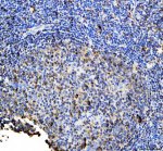 HLA-DRB1 Rabbit Polyclonal Antibody by IHC in Human Tonsil. Immunohistochemistry of FFPE human tonsil sections using HLA-DRB1 Rabbit Polyclonal Antibody. Strong membranous and cytoplasmic staining is observed in populations of lymphoid and antigen-presenting cells, with substantially lower staining in surrounding areas. The distribution is consistent with HLA-DR expression in immune-cell-rich tonsillar tissue and supports detection of the MHC class II DR beta chain by immunohistochemistry.