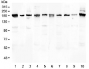 Western blot testing of 1) human placenta 2) human U-2 OS, 3) human HeLa, 4) rat brain, 5) rat lung, 6) mouse brain, 7) mouse lung, 8) mouse kidney, 9) mouse spleen and 10) mouse Neuro-2a lysate with PCDH15 antibody at 0.5ug/ml. Isoforms have been observed with molecular weights of: 250, 180, 160, 130, 90 and 60 kDa.