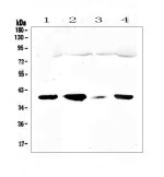 CD87 Antibody Mouse and Rat WB. Western blot analysis of mouse and rat samples using CD87 Antibody at 0.5 ug/ml. Lane 1: rat testis tissue lysate, Lane 2: mouse small intestine tissue lysate, Lane 3: mouse kidney tissue lysate, Lane 4: mouse testis tissue lysate. An HRP-conjugated secondary antibody with ECL substrate was used for detection. CD87 Antibody, recognizing uPAR/PLAUR, detects a prominent band at approximately 39 kDa, consistent with the expected molecular weight of the uPA receptor. This result supports detection of CD87, a cell surface receptor involved in immune regulation, extracellular matrix remodeling, and cell migration pathways.