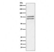 Western blot testing of human Jurkat cell lysate with ADAM10 antibody. Predicted molecular weight: ~84 kDa (full length), ~60 kDa (active form), ~80 kDa (glycosylated active form), ~110 kDa (glycosylated full length).