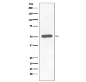 Phospho-CHK1 Antibody HEK293 WB. Western blot analysis of human HEK293 cell lysate treated with Calyculin A using phospho-CHK1 antibody detecting CHK1 phosphorylated at Ser296, clone FEO-3. A band is observed at approximately 54 kDa, consistent with the predicted molecular weight of CHK1. Detection under phosphatase inhibition conditions is consistent with phosphorylation-associated activation of DNA damage checkpoint signaling.