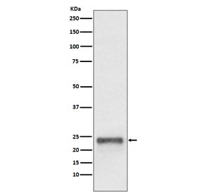 Ubiquitin D Antibody Human HepG2 WB. Western blot analysis of Ubiquitin D expression was performed using anti-Ubiquitin D antibody in human HepG2 cell lysate. Ubiquitin D, also known as FAT10 (UBD), is a ubiquitin-like modifier that targets substrate proteins for proteasomal degradation and participates in immune regulation, inflammatory signaling, and cellular stress responses. A specific immunoreactive band is detected at approximately 18â22 kDa, corresponding to the expected molecular weight range of Ubiquitin D. Expression in HepG2 cells is consistent with the reported upregulation of FAT10 in hepatocellular carcinoma and its role in protein homeostasis and tumor biology. These results support the utility of Ubiquitin D Antibody for studies of ubiquitin-like protein conjugation, proteasomal degradation, immune signaling, and cancer research.