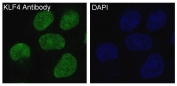 Immunofluorescent staining of FFPE human HeLa cells with KLF4 antibody (green) and DAPI nuclear stain (blue). HIER: steam section in pH6 citrate buffer for 20 min.