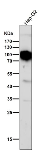 TGN46 Antibody Human Liver Cancer Cell WB. Western blot analysis of human HepG2 cell lysate using TGN46 Antibody / TGOLN2 (clone AOHO-20) at 1:1000 dilution. An HRP-conjugated secondary antibody with ECL substrate was used for detection. This recombinant rabbit monoclonal TGN46 Antibody detects a broad band at approximately 80-110 kDa, consistent with the expected migration pattern of highly glycosylated TGOLN2/TGN46 protein. Detection supports studies of trans-Golgi network structure, intracellular protein sorting, vesicle trafficking, and regulation of secretory pathway function.