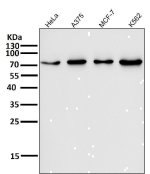 Forkhead Box O3 Antibody Human Cancer Cell WB. Western blot analysis was performed using FOXO3A Antibody on lane 1: human HeLa, lane 2: human A375, lane 3: human MCF-7, and lane 4: human K562 cell lysates. A distinct immunoreactive band is detected at approximately 71â90 kDa in all samples, consistent with the expected migration of FOXO3A, which commonly migrates above its predicted molecular weight due to glycosylation and other post-translational modifications. Expression across epithelial, melanoma, breast cancer, and leukemia cell lines demonstrates the broad distribution of this forkhead transcription factor. This Forkhead Box O3 Antibody / FOXO3A Antibody is well suited for Western blot studies of transcriptional regulation, PI3K/AKT signaling, apoptosis, oxidative stress responses, and cell fate determination.