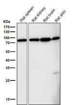FOXO3A Antibody Rat Tissue WB. Western blot analysis was performed using FOXO3A Antibody on lane 1: rat spleen, lane 2: rat kidney, lane 3: rat brain, and lane 4: rat skin tissue lysates. A prominent immunoreactive band is detected at approximately 80â100 kDa in all tissues, consistent with the expected migration of FOXO3A, which commonly migrates above its predicted molecular weight due to post-translational modifications. Expression is observed across multiple rat tissues, demonstrating the broad distribution of this forkhead transcription factor. This FOXO3A Antibody / Forkhead Transcription Factor Antibody is well suited for Western blot studies of FOXO3A expression, transcriptional regulation, apoptosis, oxidative stress responses, and PI3K/AKT signaling.