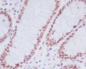 KDM1A / LSD1 Antibody Human Colon IHC. Immunohistochemistry analysis of FFPE human colon tissue stained with KDM1A / LSD1 Antibody / Histone Demethylase clone DID-11. Nuclear HRP-DAB brown staining is observed in colon epithelial cells, consistent with the chromatin-associated localization expected for Lysine-specific demethylase 1 / KDM1A within histone demethylase and transcriptional regulatory complexes.