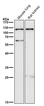 TLR5 Antibody Mouse Lung and Rat Kidney Tissue WB. Western blot analysis of mouse lung and rat kidney lysates using TLR5 Antibody clone AADF-20. Lane 1: mouse lung. Lane 2: rat kidney. A strong immunoreactive band is detected at approximately 115-120 kDa in both tissue lysates, consistent with the mature glycosylated form of TLR5. Although the predicted molecular weight of the TLR5 polypeptide is approximately 98 kDa, N-linked glycosylation commonly results in slower electrophoretic migration and an apparent molecular weight of approximately 110-120 kDa. These results demonstrate that this TLR5 Antibody, a Flagellin Receptor Antibody, specifically detects endogenous TLR5 in rodent tissues by Western blot.