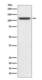 TLR5 Antibody HeLa Cell WB. Western blot analysis of human HeLa cell lysate using TLR5 Antibody clone AADF-20. A single prominent band is detected at approximately 98 kDa, consistent with the expected molecular weight of TLR5. The clean, specific immunoreactive band demonstrates endogenous expression of TLR5 in HeLa cells and supports the antibody's specificity for this membrane-associated pattern recognition receptor. These results demonstrate that this TLR5 Antibody, a Flagellin Receptor Antibody, is suitable for detecting endogenous TLR5 by Western blot.