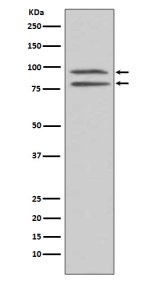 Phospho-MSK1 (S376) Antibody EGF Treated HEK293 Cell WB. Western blot analysis of human HEK293 cell lysate treated with EGF using Phospho-MSK1 (S376) Antibody, clone FCF-18. A specific band is detected at approximately 90 kDa, consistent with the predicted molecular weight of phosphorylated MSK1. EGF stimulation activates upstream MAPK signaling pathways that promote MSK1 phosphorylation. These results support the use of Phospho-MSK1 (S376) Antibody, clone FCF-18 for studying MSK1 activation, MAPK signaling pathways and phosphorylation-dependent cellular responses.