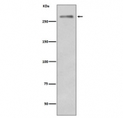Dysferlin Antibody Skeletal Muscle WB. Western blot analysis of mouse skeletal muscle lysate using Dysferlin Antibody / Muscle Membrane Repair Protein clone EGO-4. A distinct band is detected at approximately 260-270 kDa, corresponding to Dysferlin / DYSF. The observed molecular weight is slightly higher than the predicted molecular weight of approximately 237 kDa, a finding that can occur with large membrane-associated proteins. Dysferlin is a ferlin family protein that plays a critical role in calcium-dependent sarcolemmal repair and maintenance of muscle fiber integrity. The strong signal observed in skeletal muscle is consistent with the established expression of Dysferlin in contractile tissues that undergo repeated mechanical stress and membrane remodeling.