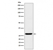 Western blot testing of human fetal brain lysate with SCGN antibody. Predicted molecular weight ~32 kDa.