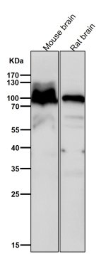 AP2A1 Antibody Mouse and Rat Brain WB. Western blot testing of mouse brain and rat brain lysates with AP2A1 Antibody at 1:6000 dilution. Samples were incubated with AP2A1 antibody for 1 hour at room temperature. A major band was detected at approximately 100 kDa, consistent with the expected molecular weight of AP2A1. AP2A1 Antibody supports detection of alpha adaptin expression and studies of adaptor protein complex function, clathrin-mediated endocytosis, membrane trafficking and intracellular transport pathways.